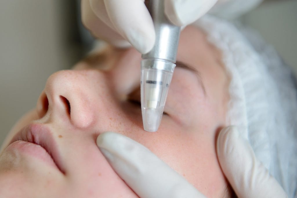 Neo Elite melasma treatment