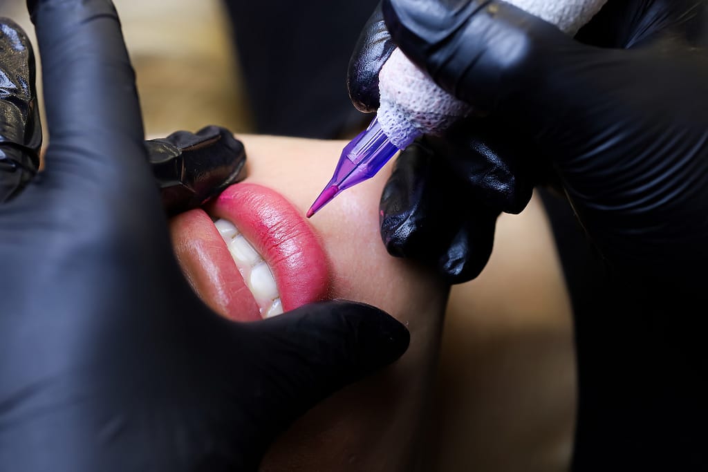 electrolysis treatment