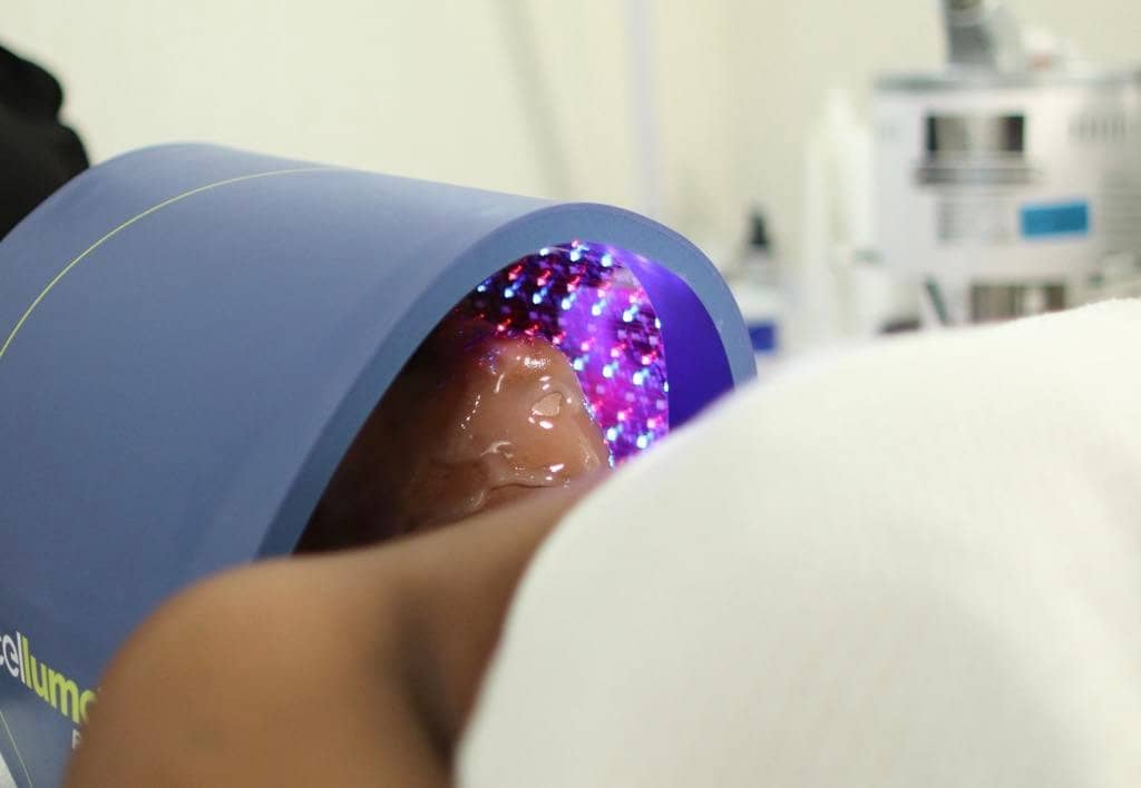 LED Light Therapy