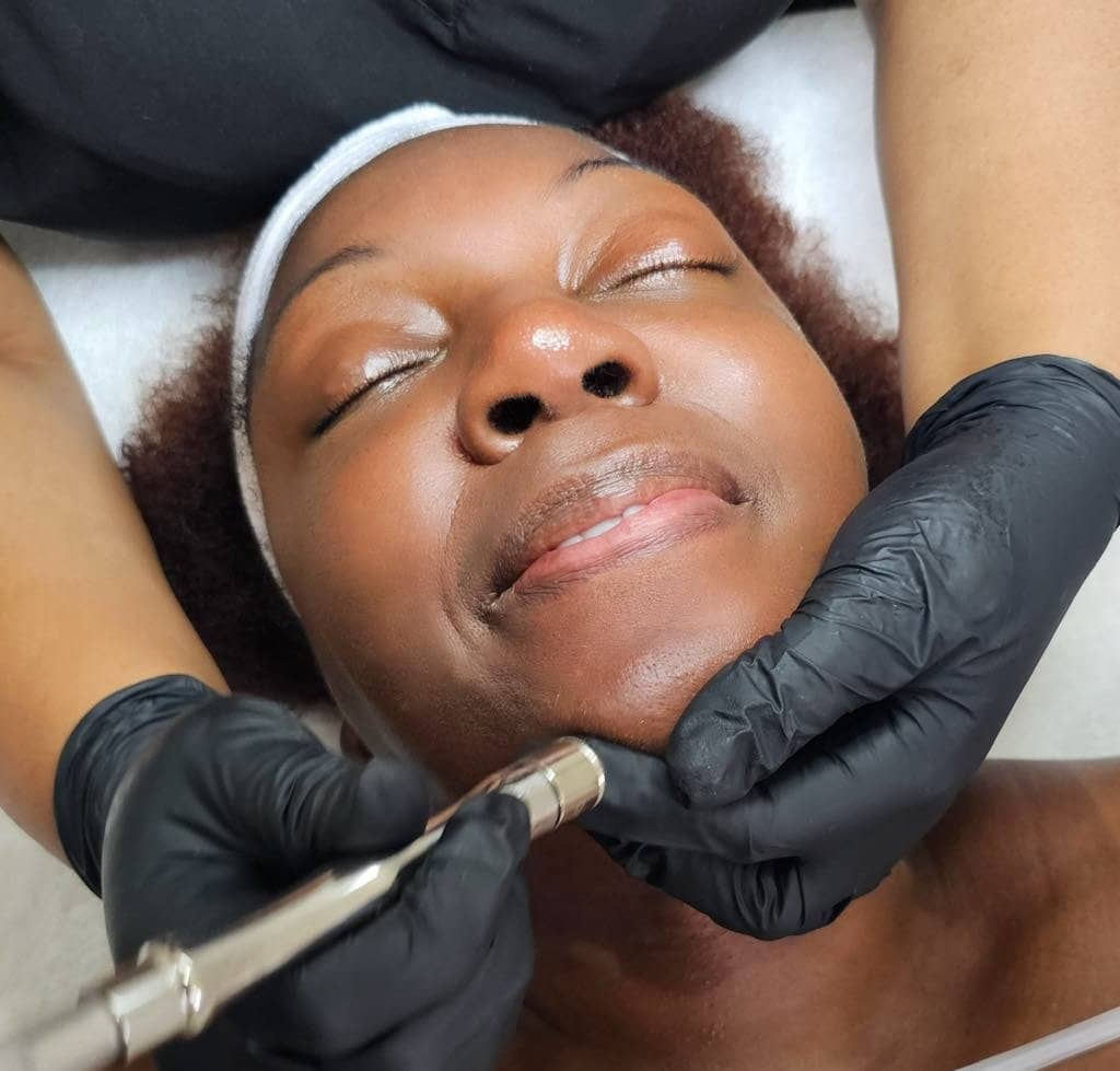 Microdermabrasion near me